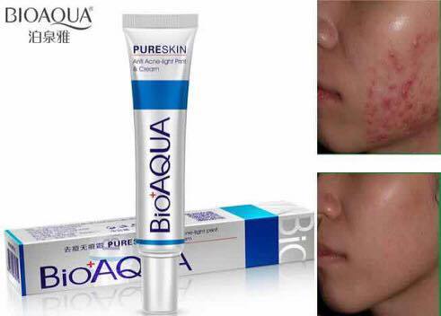 BIO AQUA ACNE REMOVAL CREAM