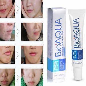 BIO AQUA ACNE REMOVAL CREAM