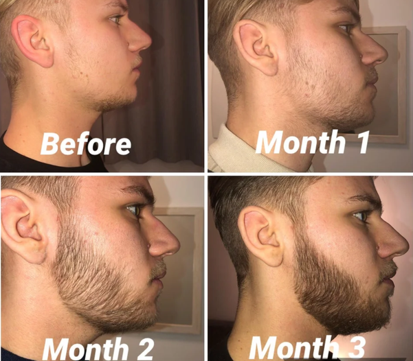 DR-RASHEL ORIGINAL BEARD OIL